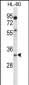 EGLN3 Antibody (C-term)