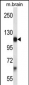 Mouse Pdgfra Antibody (Center)