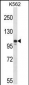 Mouse Jak3 Antibody (N-term)