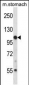 Mouse Jak3 Antibody (N-term)