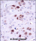 Mouse Matk Antibody (C-term)