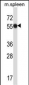 Mouse Matk Antibody (C-term)