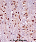 Mouse Prkca Antibody (N-term)