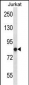 Mouse Prkca Antibody (N-term)