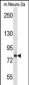 Mouse Prkca Antibody (N-term)