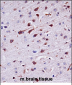 Mouse Ptk2b Antibody (Center)