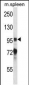 Mouse Ptk2b Antibody (Center)