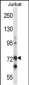 Mouse Raf1 Antibody (N-term)