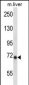 Mouse Ikbke Antibody (Center)