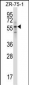 Mouse Rps6kb1 Antibody (C-term)