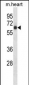 Mouse Rps6kb1 Antibody (C-term)