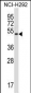 Mouse Rage Antibody (N-term)