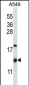 HIGD2A Antibody (N-term)