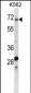 TRIP10 Antibody (N-term)