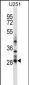 HOXC4 Antibody (C-term)