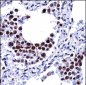 ARIH2 Antibody (C-term)