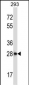 CTDSP2 Antibody (N-term)