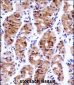 GTF2E1 Antibody (N-term)