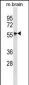 Mouse Mapk4 Antibody (N-term)