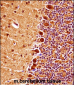 Mouse Mapk9 Antibody (Center)