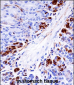 Mouse Mapkapk5 Antibody (N-term)