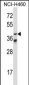 Mouse Mapkapk5 Antibody (N-term)