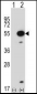 Mouse Mapkapk5 Antibody (N-term)