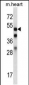 Mouse Mapkapk5 Antibody (N-term)