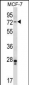 Mouse Pak4 Antibody (Center)