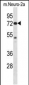 Mouse Pak4 Antibody (Center)