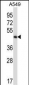 Mouse Phkg2 Antibody (N-term)