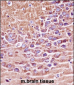 Mouse Prkaca/Prkacb Antibody (C-term)