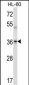 Mouse Prkaca/Prkacb Antibody (C-term)