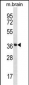 Mouse Prkaca/Prkacb Antibody (C-term)