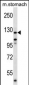 Mouse Ptk2 Antibody (Center)