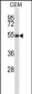 Mouse Styk1 Antibody (Center)