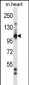 Mouse Tie1 Antibody (Center)