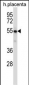 Mouse Yes1 Antibody (N-term)