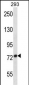 ADAM32 Antibody (N-term)