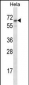 STS Antibody (C-term)