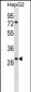 KLK10 Antibody (N-term)