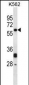 NMT2 Antibody (C-term)