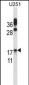 CGB/hCG-Beta Antibody (Center)