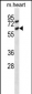 Mouse Acvr1c Antibody (C-term)