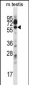 Mouse Chek1 Antibody (Center)