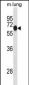 Mouse Dyrk1b Antibody (Center)