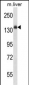 Mouse Insr Antibody (Center)