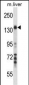 Mouse Map3k1 Antibody (C-term)