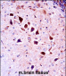 Mouse Ntrk3 Antibody (N-term)