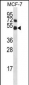 Mouse Mapk8 Antibody (Center)